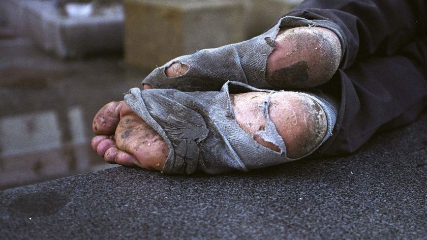 image of tattered socks on someones feet